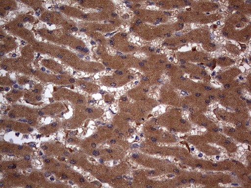 ARAF / ARAF1 / A-RAF Antibody - IHC of paraffin-embedded Human liver tissue using anti-ARAF mouse monoclonal antibody. (Heat-induced epitope retrieval by 1 mM EDTA in 10mM Tris, pH8.5, 120°C for 3min).