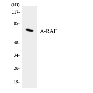 ARAF / ARAF1 / A-RAF Antibody - Western blot analysis of the lysates from HeLa cells using A-RAF antibody.