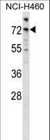 ARAF / ARAF1 / A-RAF Antibody - Mouse Araf Antibody western blot of NCI-H460 cell line lysates (35 ug/lane). The Araf antibody detected the Araf protein (arrow).