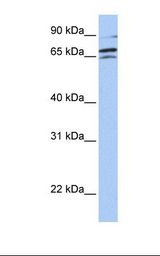 ARAF / ARAF1 / A-RAF Antibody - Fetal brain lysate. Antibody concentration: 1.0 ug/ml. Gel concentration: 12%.  This image was taken for the unconjugated form of this product. Other forms have not been tested.