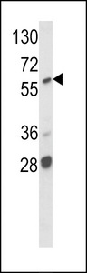 ARAF / ARAF1 / A-RAF Antibody - Western blot of hARAF1-H270 in MCF7 cell line lysates (35 ug/lane). ARAF1 (arrow) was detected using the purified antibody.