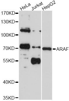 ARAF / ARAF1 / A-RAF Antibody - Western blot analysis of extracts of various cell lines, using ARAF antibody at 1:1000 dilution. The secondary antibody used was an HRP Goat Anti-Rabbit IgG (H+L) at 1:10000 dilution. Lysates were loaded 25ug per lane and 3% nonfat dry milk in TBST was used for blocking. An ECL Kit was used for detection and the exposure time was 5s.
