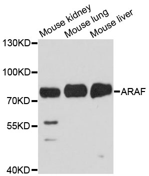 ARAF / ARAF1 / A-RAF Antibody - Western blot analysis of extracts of various cell lines, using ARAF antibody at 1:1000 dilution. The secondary antibody used was an HRP Goat Anti-Rabbit IgG (H+L) at 1:10000 dilution. Lysates were loaded 25ug per lane and 3% nonfat dry milk in TBST was used for blocking. An ECL Kit was used for detection and the exposure time was 10s.