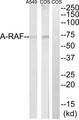 ARAF / ARAF1 / A-RAF Antibody - Western blot analysis of extracts from Cos7 and A549 cells, using A-RAF antibody.