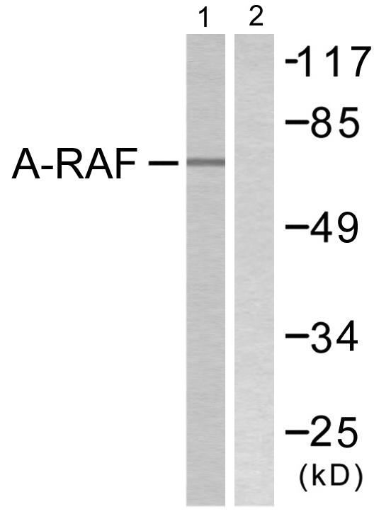 ARAF / ARAF1 / A-RAF Antibody - Western blot analysis of extracts from HeLa cells, treated with PMA (125ng/ml, 30mins), using A-RAF (Ab-301/302) antibody.