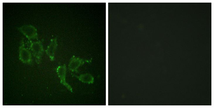 ARAF / ARAF1 / A-RAF Antibody - Immunofluorescence analysis of HepG2 cells, using A-RAF (Phospho-Tyr302) Antibody. The picture on the right is blocked with the phospho peptide.