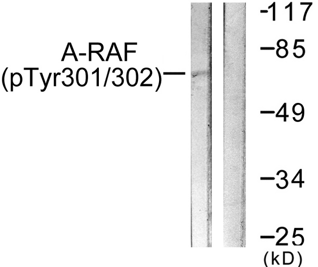 ARAF / ARAF1 / A-RAF Antibody - Western blot analysis of lysates from HeLa cells treated with PMA 125ng/ml 30', using A-RAF (Phospho-Tyr302) Antibody. The lane on the right is blocked with the phospho peptide.