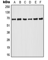 ARAF / ARAF1 / A-RAF Antibody - Western blot analysis of A-RAF (pY302) expression in HeLa PMA-treated (A); Raji (B); HT29 (C); NIH3T3 (D); SP2/0 PMA-treated (E); PC12 PMA-treated (F) whole cell lysates.