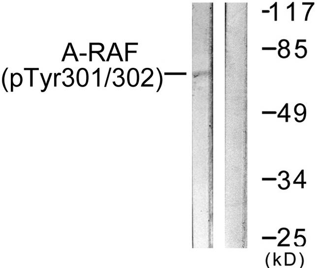 ARAF / ARAF1 / A-RAF Antibody - Western blot analysis of extracts from HeLa cells, treated with PMA (125ng/ml, 30mins), using A-RAF (Phospho-Tyr301/302) antibody.