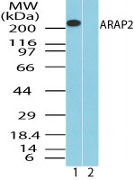 ARAP2 / CENTD1 Antibody - Western blot of ARAP2 in human kidney lysate in the 1) absence and 2) presence of immunizing peptide using Polyclonal Antibody to ARAP2 at 1.0 ug/ml. Goat anti-rabbit Ig HRP secondary antibody, and PicoTect ECL substrate solution, were used for this test.