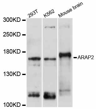 ARAP2 / CENTD1 Antibody - Western blot analysis of extracts of various cell lines, using ARAP2 antibody at 1:1000 dilution. The secondary antibody used was an HRP Goat Anti-Rabbit IgG (H+L) at 1:10000 dilution. Lysates were loaded 25ug per lane and 3% nonfat dry milk in TBST was used for blocking. An ECL Kit was used for detection and the exposure time was 5s.
