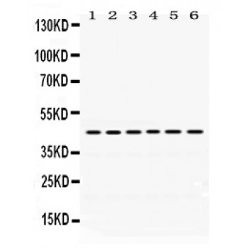 ARC / Arg3.1 Antibody - Arc antibody Western blot. All lanes: Anti Arc at 0.5 ug/ml. Lane 1: Rat Brain Tissue Lysate at 50 ug. Lane 2: Rat Testis Tissue Lysate at 50 ug. Lane 3: Mouse Brain Tissue Lysate at 50 ug. Lane 4: PANC Whole Cell Lysate at 40 ug. Lane 5: HELA Whole Cell Lysate at 40 ug. Lane 6: MCF-7 Whole Cell Lysate at 40 ug. Predicted band size: 45 kD. Observed band size: 45 kD.