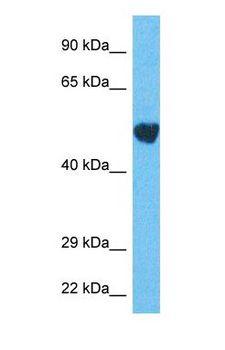 ARC / Arg3.1 Antibody - Western blot of ARC Antibody with human Jurkat Whole Cell lysate.  This image was taken for the unconjugated form of this product. Other forms have not been tested.