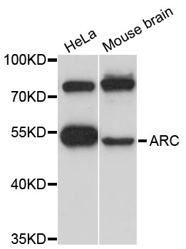 ARC / Arg3.1 Antibody - Western blot analysis of extracts of various cell lines.