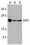 ARC / Arg3.1 Antibody - Western blot analysis of ARC in HeLa (H), KB (K), and A549 (A) whole cell lysates with ARC antibody at 1ug/ml.
