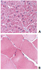 ARC / Arg3.1 Antibody - Immunohistochemistry of ARC in human heart tissue (A) and skeletal muscle (B) with ARC antibody at 5 µg/ml.