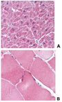 ARC / Arg3.1 Antibody - Immunohistochemistry of ARC in human heart tissue (A) and skeletal muscle (B) with ARC antibody at 5 µg/ml.