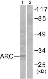 ARC / Arg3.1 Antibody - Western blot analysis of extracts from HeLa cells, using ARC antibody.
