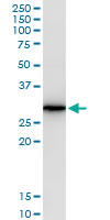 AREG / Amphiregulin Antibody - AREG monoclonal antibody (M06), clone 3E4. Western Blot analysis of AREG expression in human pancreas.
