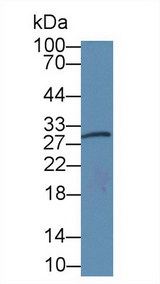 AREG / Amphiregulin Antibody - Western Blot; Sample: Rat Placenta lysate; Primary Ab: 3µg/ml Mouse Anti-Human AREG Antibody Second Ab: 0.2µg/mL HRP-Linked Caprine Anti-Mouse IgG Polyclonal Antibody
