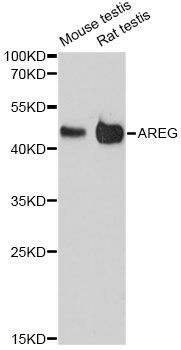 AREG / Amphiregulin Antibody - Western blot analysis of extracts of various cell lines, using AREG antibody at 1:3000 dilution. The secondary antibody used was an HRP Goat Anti-Rabbit IgG (H+L) at 1:10000 dilution. Lysates were loaded 25ug per lane and 3% nonfat dry milk in TBST was used for blocking. An ECL Kit was used for detection and the exposure time was 90s.