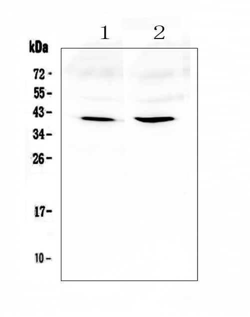 AREG / Amphiregulin Antibody - Western blot analysis of Amphiregulin using anti-Amphiregulin antibody. Electrophoresis was performed on a 5-20% SDS-PAGE gel at 70V (Stacking gel) / 90V (Resolving gel) for 2-3 hours. The sample well of each lane was loaded with 50ug of sample under reducing conditions. Lane 1: rat brain tissue lysates,Lane 2: mouse brain tissue lysates. After Electrophoresis, proteins were transferred to a Nitrocellulose membrane at 150mA for 50-90 minutes. Blocked the membrane with 5% Non-fat Milk/ TBS for 1.5 hour at RT. The membrane was incubated with rabbit anti-Amphiregulin antigen affinity purified polyclonal antibody at 0.5 µg/mL overnight at 4°C, then washed with TBS-0.1% Tween 3 times with 5 minutes each and probed with a goat anti-rabbit IgG-HRP secondary antibody at a dilution of 1:10000 for 1.5 hour at RT. The signal is developed using an Enhanced Chemiluminescent detection (ECL) kit with Tanon 5200 system. A specific band was detected for Amphiregulin at approximately 41KD. The expected band size for Amphiregulin is at 28KD.