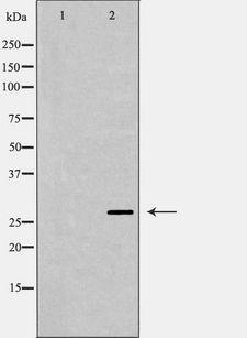 AREG / Amphiregulin Antibody - Western blot analysis of LS174T using AREG antibody. The lane on the left is treated with the antigen-specific peptide.