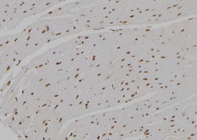 AREG / Amphiregulin Antibody - 1:100 staining rat heart tissue by IHC-P. The sample was formaldehyde fixed and a heat mediated antigen retrieval step in citrate buffer was performed. The sample was then blocked and incubated with the antibody for 1.5 hours at 22°C. An HRP conjugated goat anti-rabbit antibody was used as the secondary.