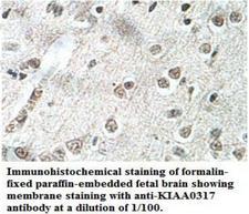 AREL1 / KIAA0317 Antibody