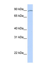 AREL1 / KIAA0317 Antibody - KIAA0317 antibody Western blot of Fetal Heart lysate. This image was taken for the unconjugated form of this product. Other forms have not been tested.
