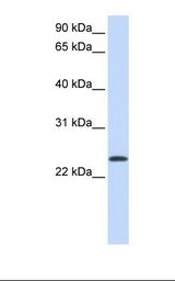 ARF1 Antibody - Fetal lung lysate. Antibody concentration: 1.0 ug/ml. Gel concentration: 12%.  This image was taken for the unconjugated form of this product. Other forms have not been tested.