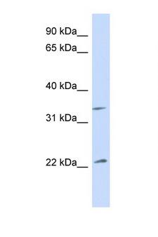 ARF1 Antibody - ARF1 antibody Western blot of Fetal Muscle lysate. Antibody concentration 1 ug/ml.  This image was taken for the unconjugated form of this product. Other forms have not been tested.