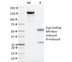 ARF1 Antibody - SDS-PAGE analysis of purified, BSA-free ARF1 antibody (clone 1A9/5) as confirmation of integrity and purity.