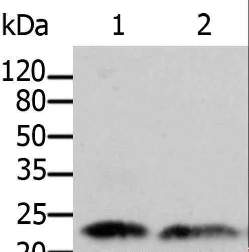ARF1 Antibody - Western blot analysis of Human fetal brain and kidney tissue, using ARF1 Polyclonal Antibody at dilution of 1:500.
