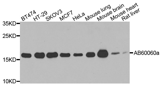 ARF1 Antibody - Western blot analysis of extracts of various cells.