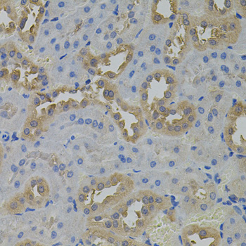 ARF1 Antibody - Immunohistochemistry of paraffin-embedded rat kidney tissue.