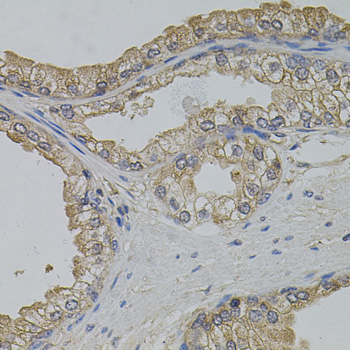 ARF1 Antibody - Immunohistochemistry of paraffin-embedded human prostate.
