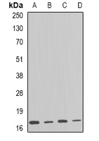 ARF1 Antibody - Western blot analysis of ARF1 expression in HT29 (A); SKOV3 (B); mouse brain (C); rat liver (D) whole cell lysates.