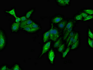 ARF1 Antibody - Immunofluorescent analysis of Hela cells diluted at 1:100 and Alexa Fluor 488-congugated AffiniPure Goat Anti-Rabbit IgG(H+L)