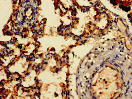 ARF1 Antibody - Immunohistochemistry of paraffin-embedded human lung tissue at dilution of 1:100