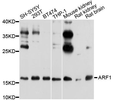 ARF1 Antibody - Western blot analysis of extracts of various cell lines, using ARF1 antibody at 1:1000 dilution. The secondary antibody used was an HRP Goat Anti-Rabbit IgG (H+L) at 1:10000 dilution. Lysates were loaded 25ug per lane and 3% nonfat dry milk in TBST was used for blocking. An ECL Kit was used for detection and the exposure time was 30s.