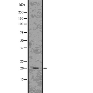 ARF1 Antibody - Western blot analysis of ARF1 using HT29 whole lysates.