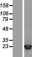 ARF1 Protein - Western validation with an anti-DDK antibody * L: Control HEK293 lysate R: Over-expression lysate