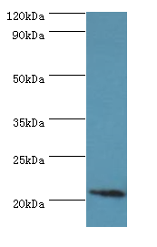 ARF3 Antibody - Western blot. All lanes: ARF3 antibody at 6 ug/ml+mouse brain tissue. Secondary antibody: Goat polyclonal to rabbit at 1:10000 dilution. Predicted band size: 21 kDa. Observed band size: 21 kDa.