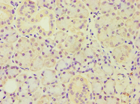 ARF3 Antibody - Immunohistochemistry of paraffin-embedded human pancreas tissue using antibody at 1:100 dilution.