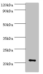 ARF3 Antibody - Western blot All lanes: ARF3 antibody at 6µg/ml + Mouse brain tissue Secondary Goat polyclonal to rabbit IgG at 1/10000 dilution Predicted band size: 21, 17 kDa Observed band size: 21 kDa