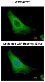 ARF3 Antibody - Immunofluorescence of methanol-fixed HeLa using ARF3 antibody at 1:500 dilution.