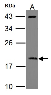 ARF3 Antibody - Sample (30 ug of whole cell lysate). A: Raji. 12% SDS PAGE. ADP-ribosylation factor 3 antibody. ARF3 antibody diluted at 1:1000