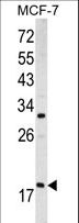 ARF3 Antibody - Western blot of ARF3 antibody (Center D93) in MCF-7 cell line lysates (35 ug/lane). ARF3 (arrow) was detected using the purified antibody.