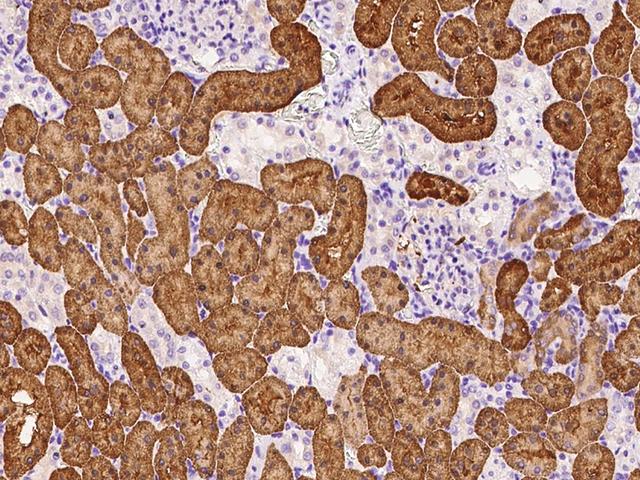 ARF3 Antibody - Immunochemical staining ARF3 in rat kidney with rabbit polyclonal antibody at 1:300 dilution, formalin-fixed paraffin embedded sections.